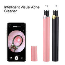 Load image into Gallery viewer, Visible Blackhead Remover Smart Blackhead Extractor with 500W HD Camera &amp; 30x Macro Facial Acne Remover
