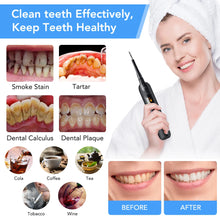 Load image into Gallery viewer, Electric Sonic Dental Calculus Remover Whitener Scaler LED Display Tooth Cleaner Rechargeable Tartar Tool Whitening Teeth Care
