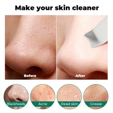 Load image into Gallery viewer, Ultrasonic Skin Scrubber Scrubber Deep Vibrate Facial Cleaner Shovel Face Scrubber Peeling Black Head Remover Facial Massager
