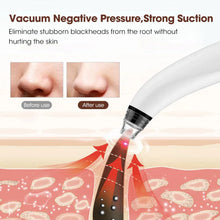 Load image into Gallery viewer, Visual Blackhead Remover Facial Pores Blackhead Cleaner Rechargeable Vacuum Suction Acne Cleaner
