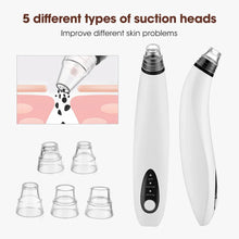 Load image into Gallery viewer, Visual Blackhead Remover Facial Pores Blackhead Cleaner Rechargeable Vacuum Suction Acne Cleaner
