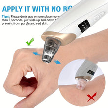 Load image into Gallery viewer, Rechargeable Blackhead Vacuum: 5-Level Gentle Suction for Deep Pore Cleaning - Shop &amp; Buy
