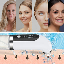 Load image into Gallery viewer, USB Rechargeable Blackhead Remover - Gentle Water Cycling Pore Cleansing, Deep Skin Cleanse - Shop &amp; Buy
